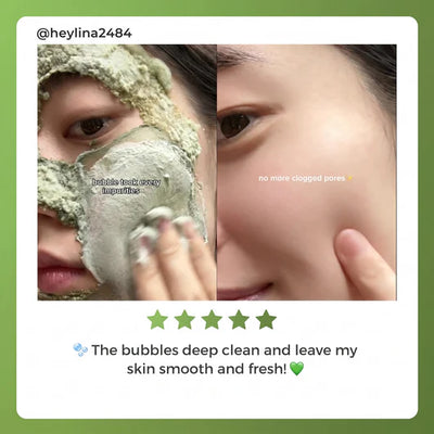 Folira Holy Basil Mask For Seborrheic Dermatitis