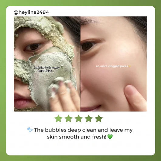 Folira Holy Basil Mask For Seborrheic Dermatitis