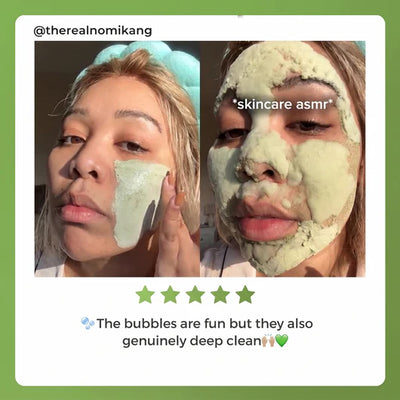 Folira Holy Basil Mask For Seborrheic Dermatitis