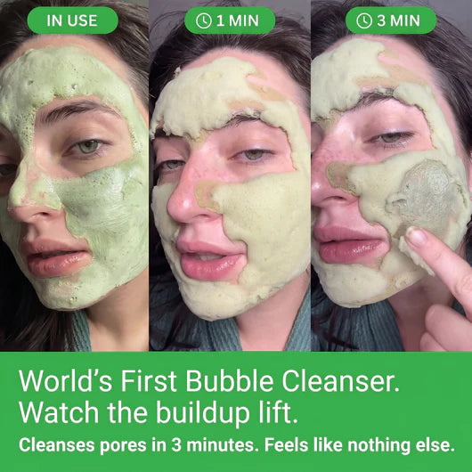 Folira Holy Basil Mask For Seborrheic Dermatitis